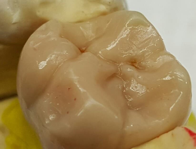 Dental model work