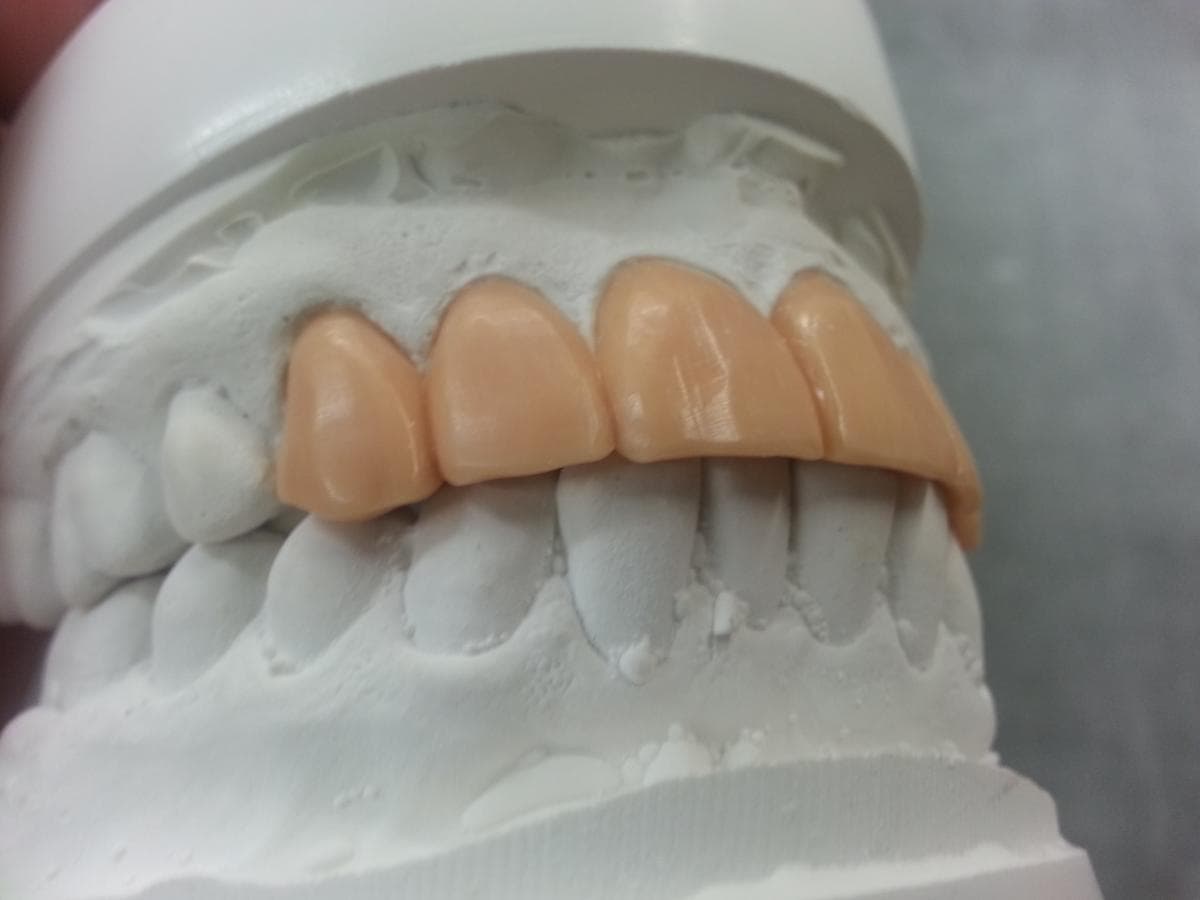 Dental lab model restoration