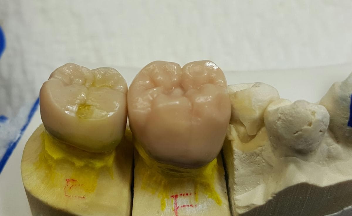 Dental prosthetic case
