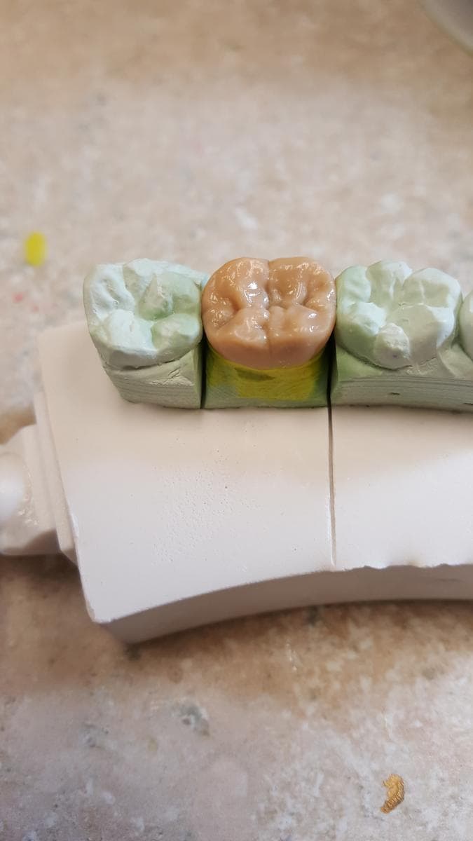 Nexus Dental Lab model work