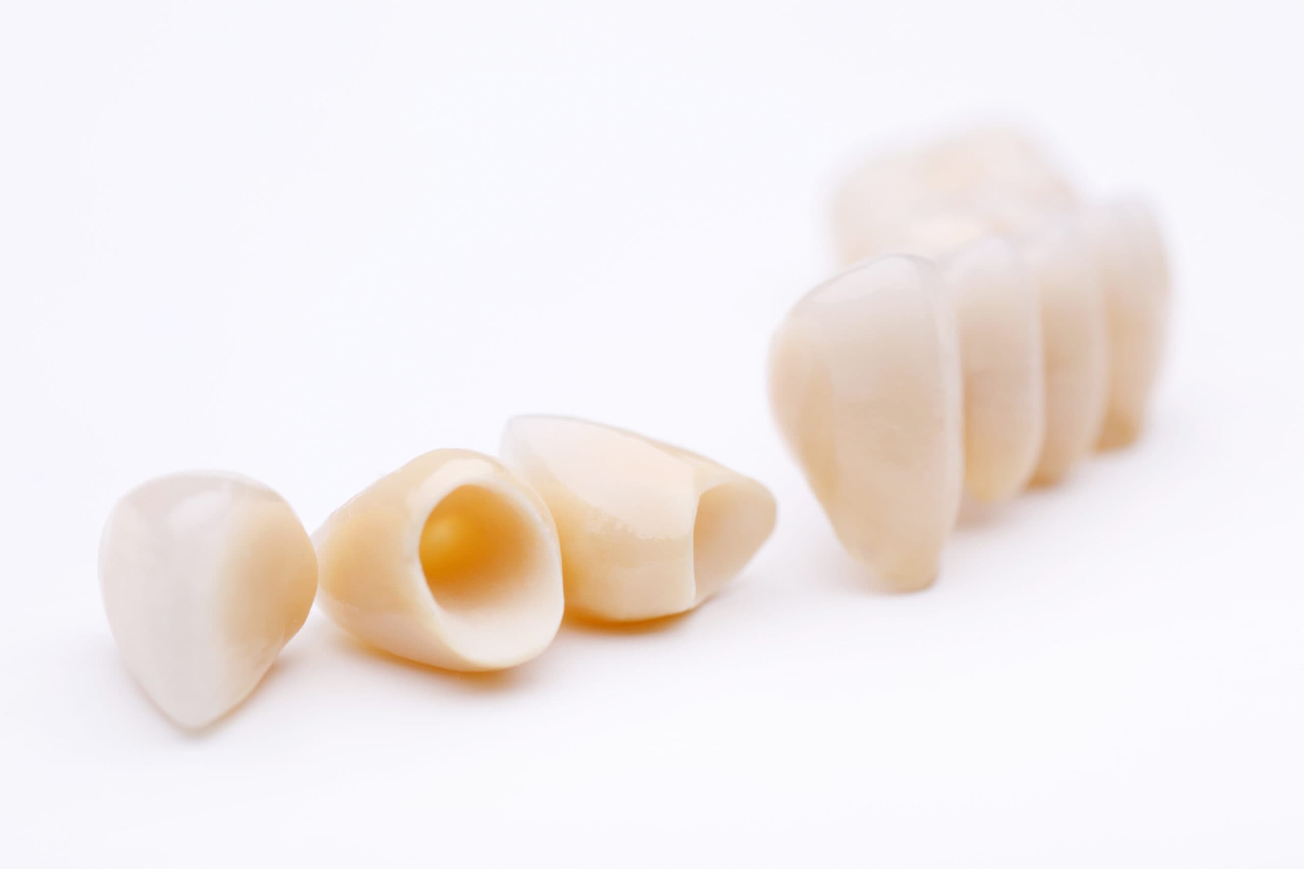 Dental restoration aesthetics