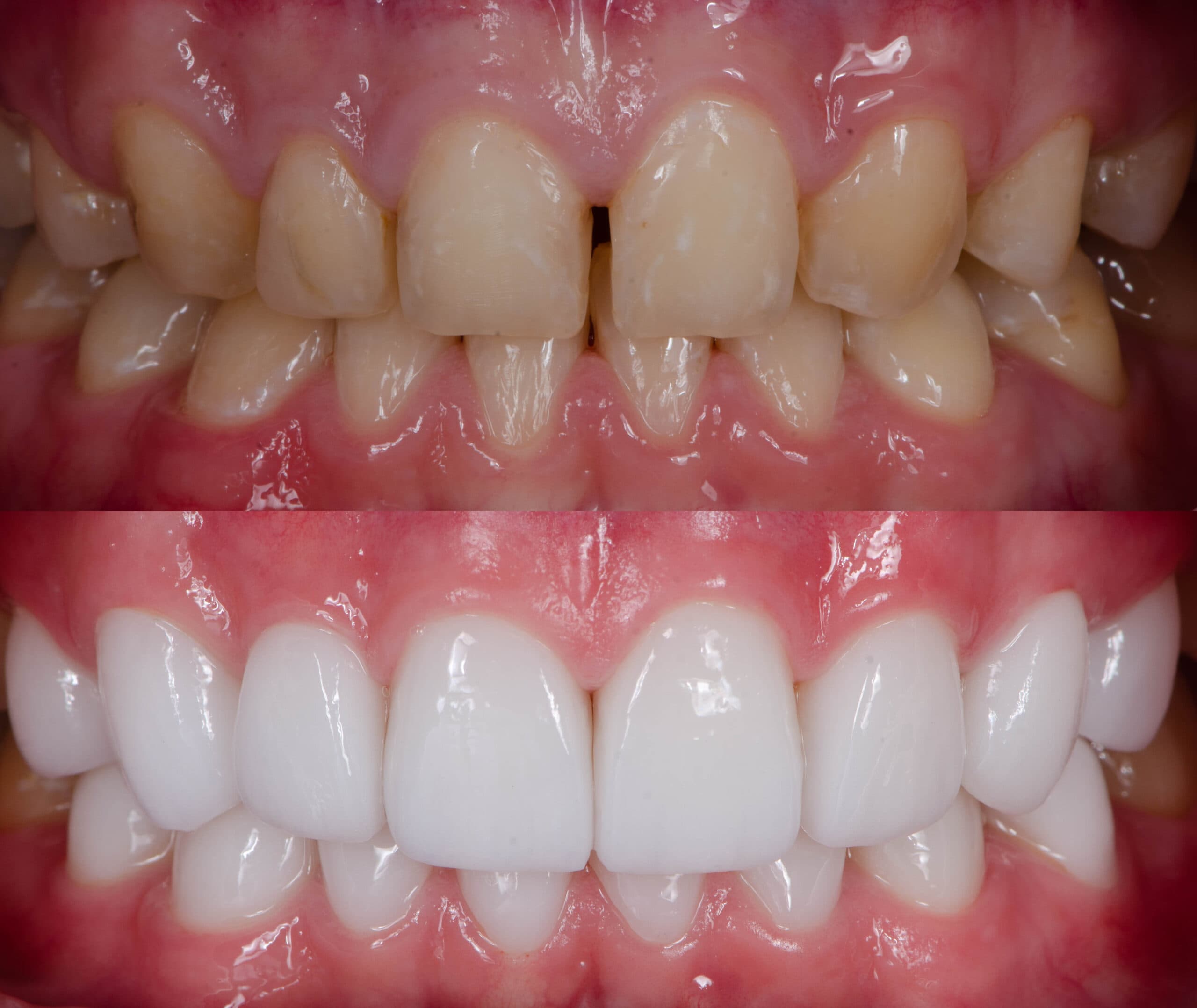 Precision dental laboratory case