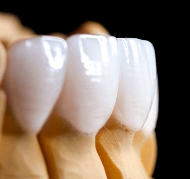 Nexus Dental Lab technician work