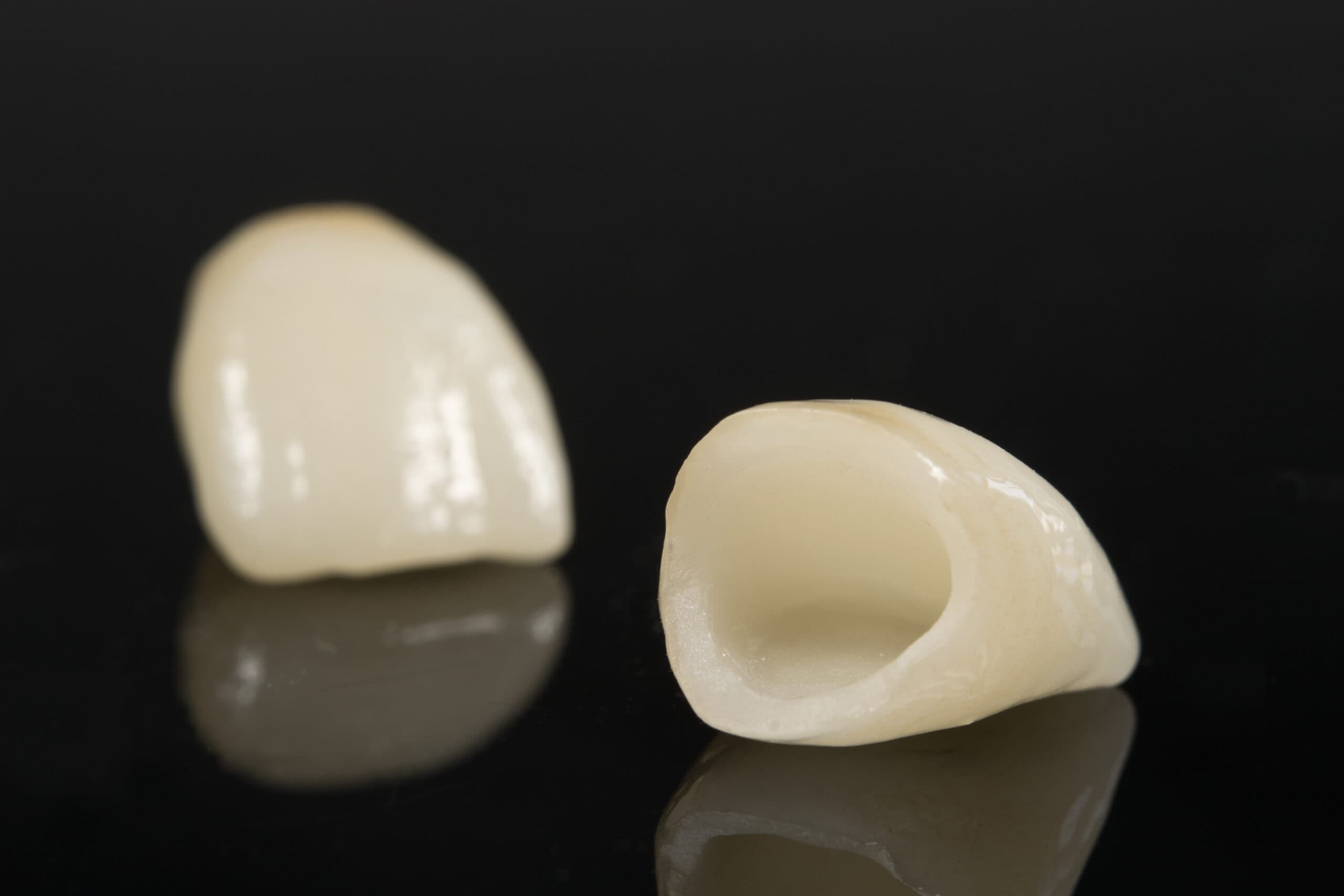 Dental lab digital workflow