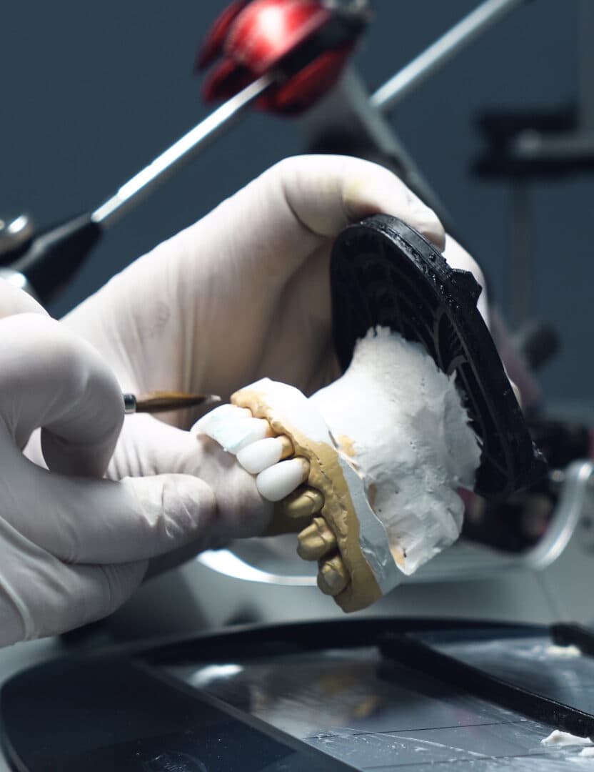Dental restoration and prosthetic guide work